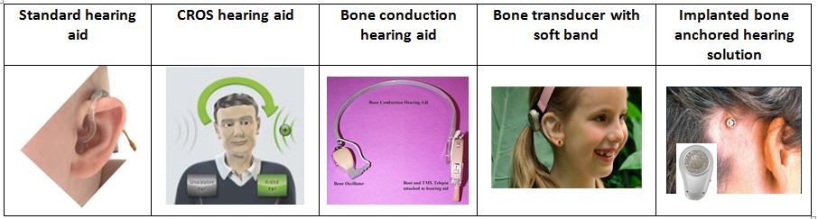 Amp options for cond HL