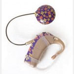 cochlear implant